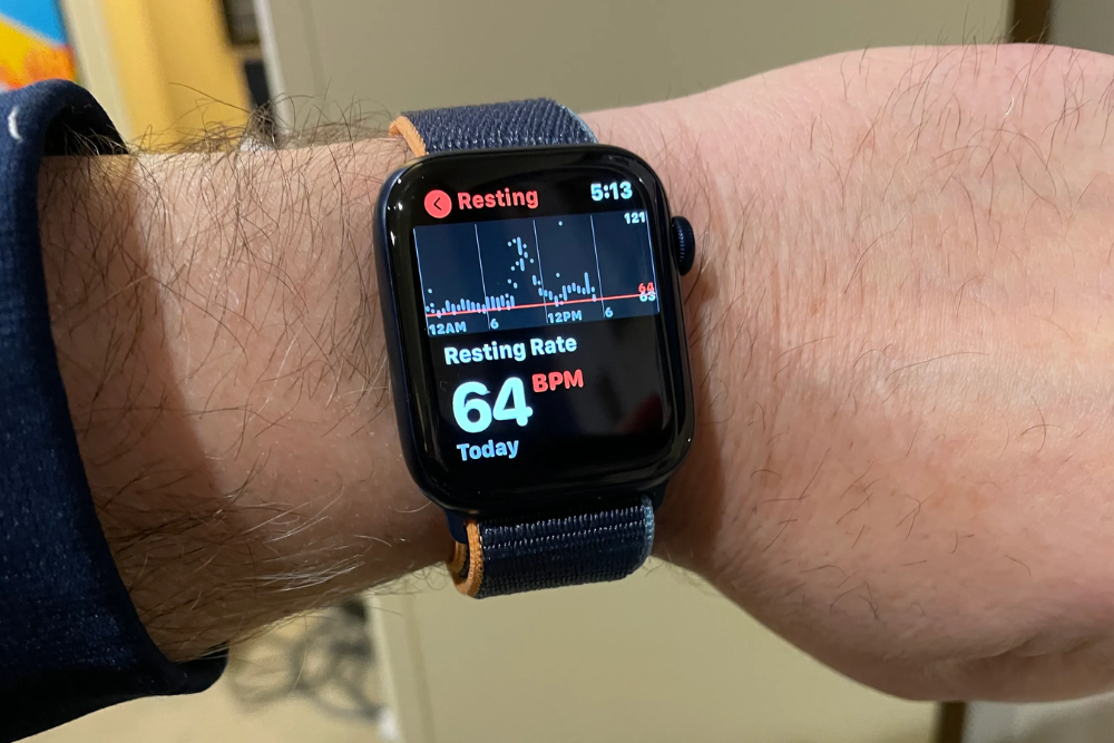 Apple Watch's Evolution: The Potential for Blood Sugar Monitoring, Blood Pressure Trends, and More